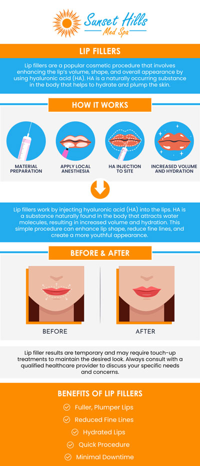 Do you want to boost your confidence and improve the appearance of your lips? then lip filler treatment is right for you. Lip fillers are a cosmetic procedure in which a gel-like substance of hyaluronic acid is injected to give the lips the appropriate shape, fullness, and plumpness. At Sunset Hill Med Spa, Andrea Warburton MSPHS, PA-C offers lip fillers to increase confidence, reduce wrinkles, and increase the size of your lips, contact us today or visit us online to book your next appointment. Your satisfaction is our top priority. We are conveniently located at 2510 Wigwam Parkway, Suite A-102, Henderson, NV 89074. Do you want to boost your confidence and improve the appearance of your lips? then lip filler treatment is right for you. Lip fillers are a cosmetic procedure in which a gel-like substance of hyaluronic acid is injected to give the lips the appropriate shape, fullness, and plumpness. At Sunset Hill Med Spa, Andrea Warburton MSPHS, PA-C offers lip fillers to increase confidence, reduce wrinkles, and increase the size of your lips, contact us today or visit us online to book your next appointment. Your satisfaction is our top priority. We are conveniently located at 2510 Wigwam Parkway, Suite A-102, Henderson, NV 89074.